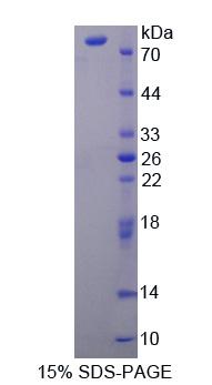 CPT2 Protein - Recombinant  Carnitine Palmitoyltransferase 2, Mitochondrial By SDS-PAGE