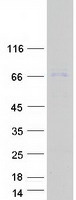 CPT2 Protein - Purified recombinant protein CPT2 was analyzed by SDS-PAGE gel and Coomassie Blue Staining