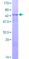 CPVL Protein - 12.5% SDS-PAGE of human CPVL stained with Coomassie Blue