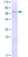 CPXCR1 / CT77 Protein - 12.5% SDS-PAGE of human CPXCR1 stained with Coomassie Blue