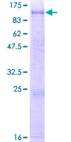 CPXM1 / CPXM Protein - 12.5% SDS-PAGE of human CPXM1 stained with Coomassie Blue