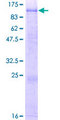 CPXM1 / CPXM Protein - 12.5% SDS-PAGE of human CPXM1 stained with Coomassie Blue
