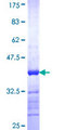 CPXM1 / CPXM Protein - 12.5% SDS-PAGE Stained with Coomassie Blue.