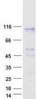 CPXM1 / CPXM Protein - Purified recombinant protein CPXM1 was analyzed by SDS-PAGE gel and Coomassie Blue Staining