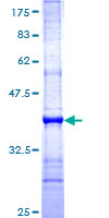 CPXM2 Protein - 12.5% SDS-PAGE Stained with Coomassie Blue.