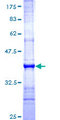 CPXM2 Protein - 12.5% SDS-PAGE Stained with Coomassie Blue.