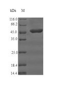 CR1 / CD35 Protein - (Tris-Glycine gel) Discontinuous SDS-PAGE (reduced) with 5% enrichment gel and 15% separation gel.