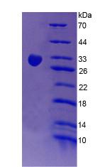 CR1 / CD35 Protein - Recombinant Complement Receptor 1, Erythrocyte By SDS-PAGE