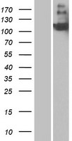 CR2 / CD21 Protein - Western validation with an anti-DDK antibody * L: Control HEK293 lysate R: Over-expression lysate