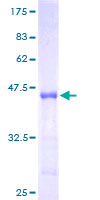 CR6 / GADD45G Protein - 12.5% SDS-PAGE of human GADD45G stained with Coomassie Blue