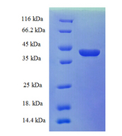 CRABP1 / CRABP Protein