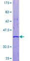 CRABP1 / CRABP Protein - 12.5% SDS-PAGE of human CRABP1 stained with Coomassie Blue
