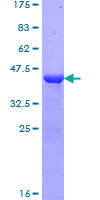 CRABP1 / CRABP Protein - 12.5% SDS-PAGE of human CRABP1 stained with Coomassie Blue