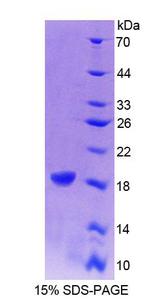 CRABP1 / CRABP Protein - Recombinant Cellular Retinoic Acid Binding Protein 1 By SDS-PAGE