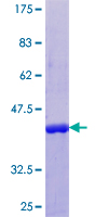 CRABP2 Protein - 12.5% SDS-PAGE of human CRABP2 stained with Coomassie Blue