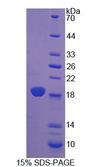 CRABP2 Protein - Recombinant Cellular Retinoic Acid Binding Protein 2 By SDS-PAGE