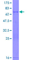 CRACR2B / EFCAB4A Protein - 12.5% SDS-PAGE of human EFCAB4A stained with Coomassie Blue