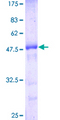 CRADD / RAIDD Protein - 12.5% SDS-PAGE of human CRADD stained with Coomassie Blue