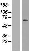 CRAT Protein - Western validation with an anti-DDK antibody * L: Control HEK293 lysate R: Over-expression lysate