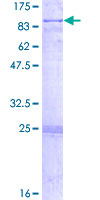 CRAT Protein - 12.5% SDS-PAGE of human CRAT stained with Coomassie Blue