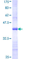 CRAT Protein - 12.5% SDS-PAGE Stained with Coomassie Blue.