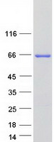 CRAT Protein - Purified recombinant protein CRAT was analyzed by SDS-PAGE gel and Coomassie Blue Staining