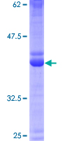 CRB3 Protein - 12.5% SDS-PAGE of human CRB3 stained with Coomassie Blue