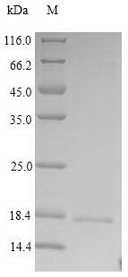 CRBN / Cereblon Protein - (Tris-Glycine gel) Discontinuous SDS-PAGE (reduced) with 5% enrichment gel and 15% separation gel.