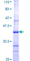 CRBN / Cereblon Protein - 12.5% SDS-PAGE Stained with Coomassie Blue.