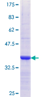 CRBPIV / RBP7 Protein - 12.5% SDS-PAGE Stained with Coomassie Blue.