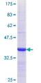 CRBPIV / RBP7 Protein - 12.5% SDS-PAGE Stained with Coomassie Blue.