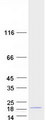 CRCP / CGRP Receptor Component Protein - Purified recombinant protein CRCP was analyzed by SDS-PAGE gel and Coomassie Blue Staining