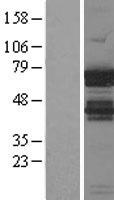CRD-BP / ZBP1 / IGF2BP1 Protein - Western validation with an anti-DDK antibody * L: Control HEK293 lysate R: Over-expression lysate