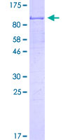 CRD-BP / ZBP1 / IGF2BP1 Protein - 12.5% SDS-PAGE of human IGF2BP1 stained with Coomassie Blue