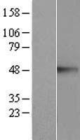 CREB3 / LZIP Protein - Western validation with an anti-DDK antibody * L: Control HEK293 lysate R: Over-expression lysate