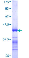 CREB3L4 / AIBZIP Protein - 12.5% SDS-PAGE Stained with Coomassie Blue.