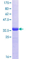 CREB3L4 / AIBZIP Protein - 12.5% SDS-PAGE Stained with Coomassie Blue.