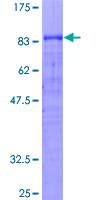 CREB5 Protein - 12.5% SDS-PAGE of human CREB5 stained with Coomassie Blue