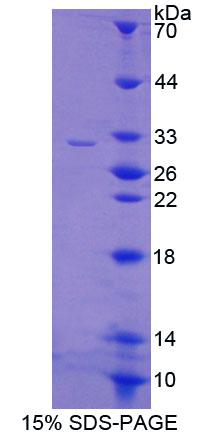 CREB5 Protein - Recombinant Cyclic AMP Response Element Binding Protein 5 (CREB5) by SDS-PAGE