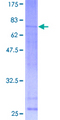 CREBL1 / ATF6B Protein - 12.5% SDS-PAGE of human CREBL1 stained with Coomassie Blue
