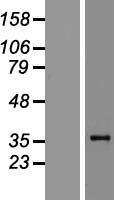 CREBZF / Zhangfei Protein - Western validation with an anti-DDK antibody * L: Control HEK293 lysate R: Over-expression lysate