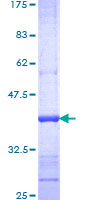 CREG / CREG1 Protein - 12.5% SDS-PAGE Stained with Coomassie Blue.