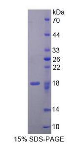 CREG / CREG1 Protein - Recombinant  Cellular Repressor Of E1A Stimulated Genes 1 By SDS-PAGE