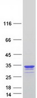 CREG / CREG1 Protein - Purified recombinant protein CREG1 was analyzed by SDS-PAGE gel and Coomassie Blue Staining