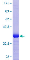 CRELD1 Protein - 12.5% SDS-PAGE Stained with Coomassie Blue.