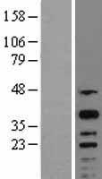 CREM / ICER Protein - Western validation with an anti-DDK antibody * L: Control HEK293 lysate R: Over-expression lysate