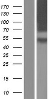 CRFR1 / CRHR1 Protein - Western validation with an anti-DDK antibody * L: Control HEK293 lysate R: Over-expression lysate