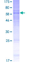 CRFR1 / CRHR1 Protein - 12.5% SDS-PAGE of human CRHR1 stained with Coomassie Blue