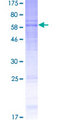 CRFR1 / CRHR1 Protein - 12.5% SDS-PAGE of human CRHR1 stained with Coomassie Blue