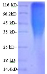 CRFR1 / CRHR1 Protein